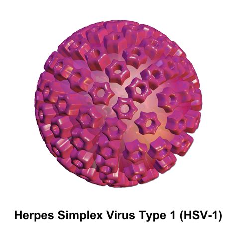 herpes simplex viruses found